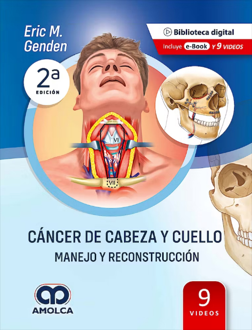 CANCER DE CABEZA Y CUELLO